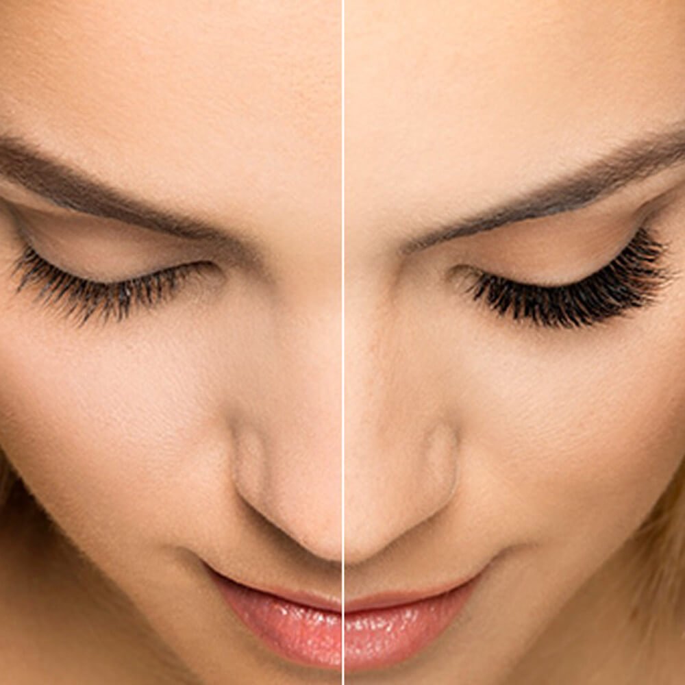 eyelash before and after