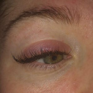 eyelash extension allergic reactions